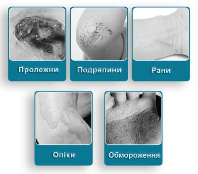 Гель с серебром антибактериальный, ранозаживляющий 